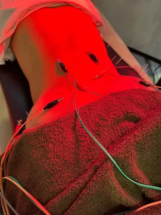 美容鍼灸整体サロンBeauJu所属・小顔矯/美容鍼/鍼灸 BeauJuのその他イメージ