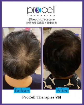 ショート メンズ the 別嬪 静岡店所属・the 別嬪 静岡店のエステ・リラクイメージ