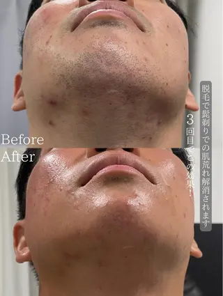 Libra所属・LIBRA/脱毛/ ホワイトニングのその他イメージ