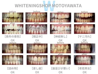 メンズ ホワイトニング ショップ本八幡店のエステ・リラクイメージ