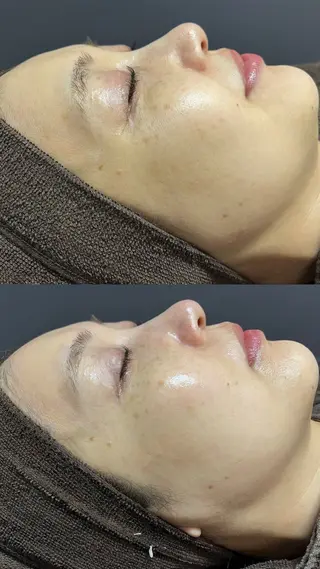 Lilyboo 池袋のエステ・リラクイメージ