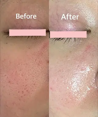 レイビス盛岡店 ♡吉田♡のエステ・リラクイメージ