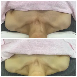 Salon Rion所属・Rion 野々村のエステ・リラクイメージ