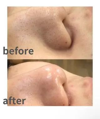 MINOA所属・MINOA 井上🌷のエステ・リラクイメージ