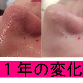 ミディアム パーマ ヘアアレンジ メンズ キッズ ネイル マツエク・マツパ ニキビ・肌質改善専門 ♡人生が変わるサロンのエステ・リラクイメージ