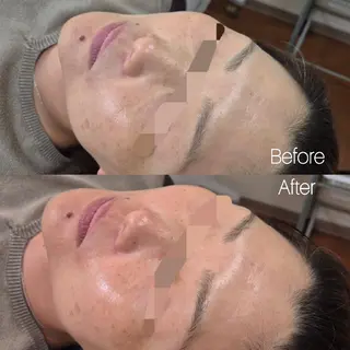 FERNABELL所属・岩本 ひなののエステ・リラクイメージ