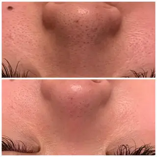 食べながら魅せボディ éclatJua川越のエステ・リラクイメージ