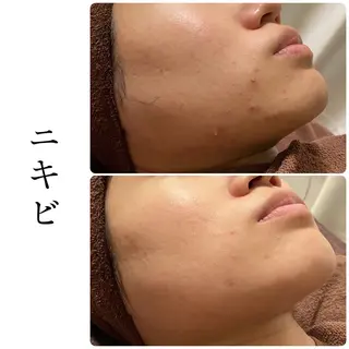 ハーブピーリング専門 BIOEL横浜のエステ・リラクイメージ