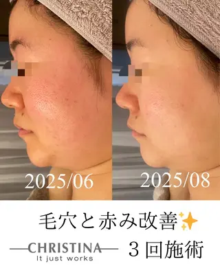 田中For..天王寺 肌質改善/よもぎ蒸しのエステ・リラクイメージ