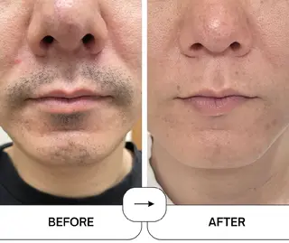 Esprit de Solidarite所属・川瀬 夢来のヘアスタイル