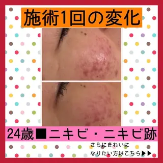 ミディアム カラー パーマ ヘアアレンジ メンズ キッズ ネイル マツエク・マツパ ニキビ・肌質改善専門 ♡人生が変わるサロンのエステ・リラクイメージ