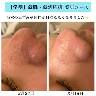 Bellesthe （ベルエステ）のエステ・リラクイメージ