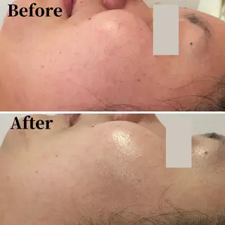 エステサロン　Sブランペタル所属・三沢市エステサロン Sブランペタルのエステ・リラクイメージ