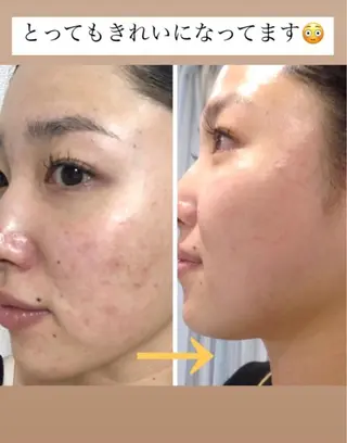 美容鍼サロン    Fleurir所属・伊藤 かなえのエステ・リラクイメージ