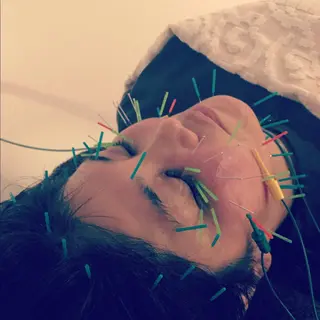 小顔矯正&美容鍼 東洋健美のエステ・リラクイメージ