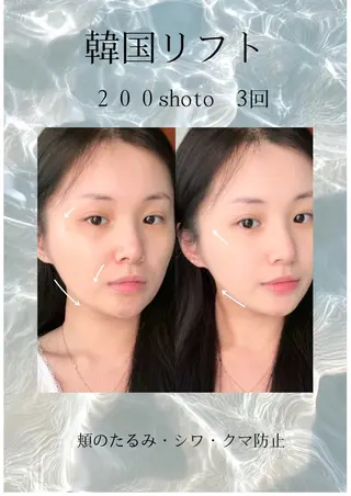 マツエク・マツパ aliaハイフ&水光ジェットサロン所属・aliaハーブ水光店 エステティシャン募集のエステ・リラクイメージ