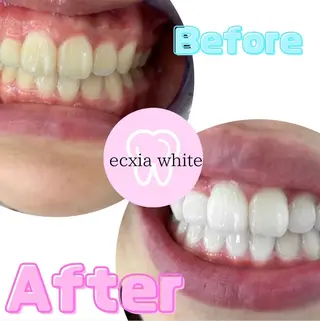 エクシアホワイト姫路店所属・セルフホワイトニング エクシア姫路店のその他イメージ