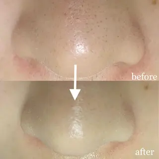 毛穴専門サロン　フルール所属・フルールFululu 自由が丘のエステ・リラクイメージ