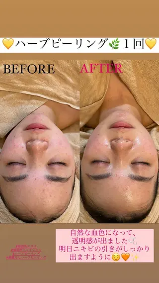 Salon de Lino 御器所のエステ・リラクイメージ