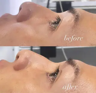 マツエク・マツパ signpost 鈴木のマツエク・マツパデザイン