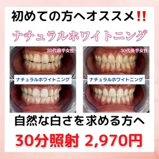 Platinum Beauty 四条烏丸店所属・吉田亮利 ホワイトニング専門店のその他イメージ