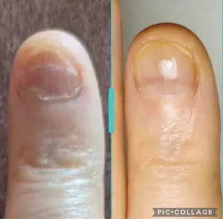 ネイル 深爪・自爪育成専門 MAHALOHIのネイルデザイン