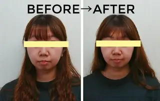 小顔矯正 頭痛専門のブライト整体 所属・ブライト整体 〜1人整体.完全予約のエステ・リラクイメージ