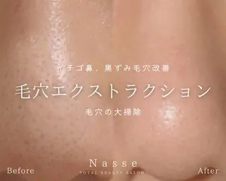 Nasse Akasakaのエステ・リラクイメージ