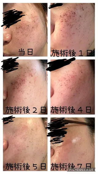 エステサロン lindyのエステ・リラクイメージ