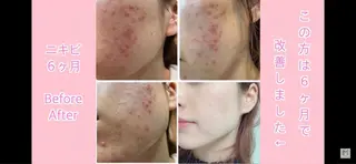 佐藤 秀美のマツエク・マツパデザイン