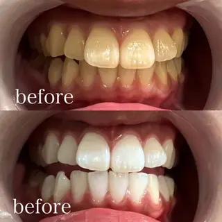 ホワイトニング×肌質 改善~elエル~のその他イメージ