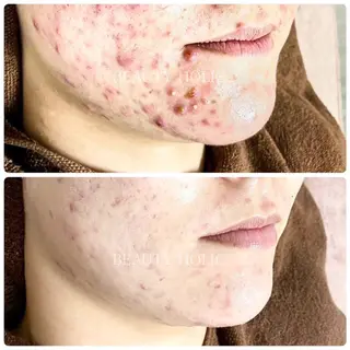 ビューティーホリック 東金店のエステ・リラクイメージ