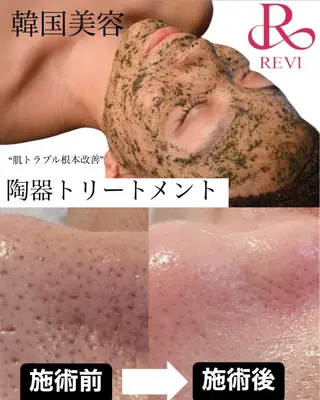 韓国肌管理Cocoh ハーブピーリングのエステ・リラクイメージ