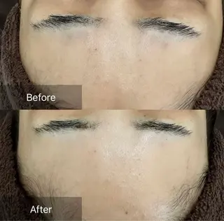 Nicore所属・Nicore NATSUKIのエステ・リラクイメージ