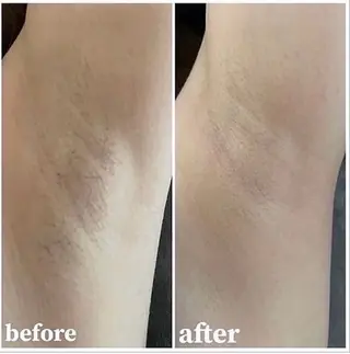 ganzan beauty所属・GANZAN yukariのエステ・リラクイメージ