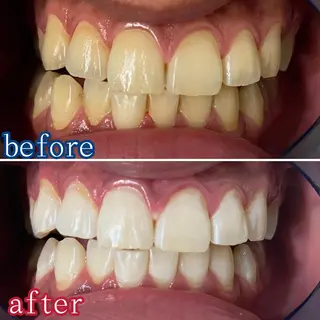 メンズ ホワイトニング ⚓︎CREW柏⚓︎のその他イメージ