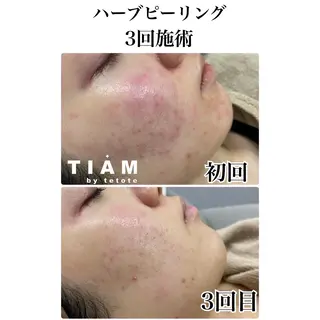 美肌サロンTIAM by tetoteのエステ・リラクイメージ