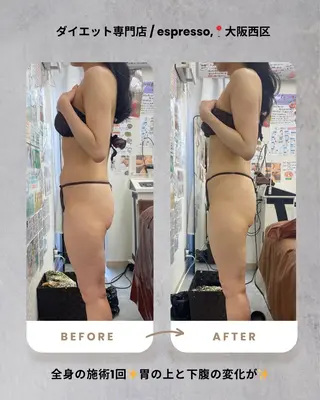 espresso,所属・《痩身、小顔専門店》 エスプレッソのエステ・リラクイメージ