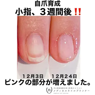 ネイル NAIL SALON ｔｏｇｇｙのネイルデザイン