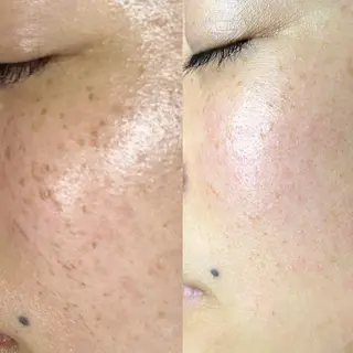 枝廣 貴子のエステ・リラクイメージ