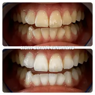 ライトビューティー 錦糸町店のエステ・リラクイメージ