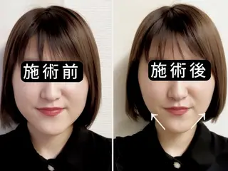 渋谷 小顔美容鍼 専門サロン YZのエステ・リラクイメージ