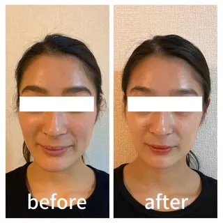 小顔サロン AMYONのエステ・リラクイメージ