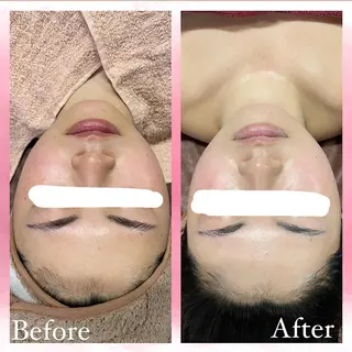 salon〜RePCa〜(サロンルピカ)所属・山﨑 藍のエステ・リラクイメージ