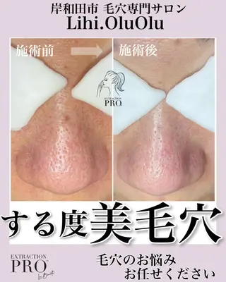 毛穴汚れ改善専門店/ 岸和田/リヒオルオルのエステ・リラクイメージ