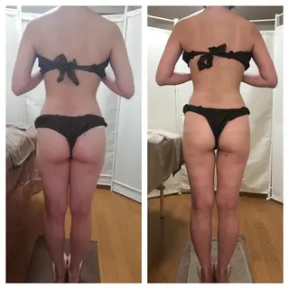 biloop所属・《痩身×疲労改善》 BILOOPのエステ・リラクイメージ