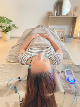 鍼灸•マッサージサロンCalfa所属・《美肌･小顔》美容鍼 ＆マッサージ＊MEIのエステ・リラクイメージ