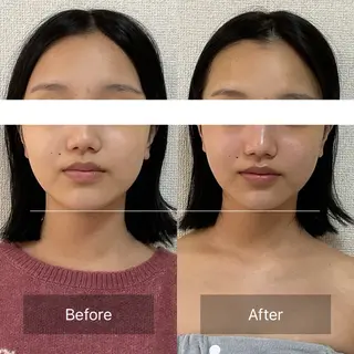 小顔＆肌質改善　お顔の印象所属・小顔×肌質改善 《お顔の印象》のエステ・リラクイメージ