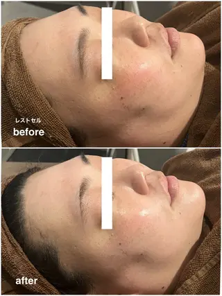 ENCHANT Kaede/肌質改善のその他イメージ