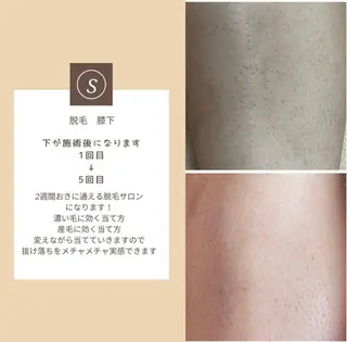 solroa  aesthetic salon所属・ソルロアエステサロン 岡村りほんのエステ・リラクイメージ